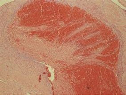 Figura 2. Hematoxilina-eosina (40x).